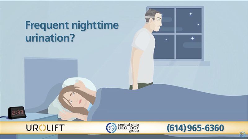 urolift-commercial
