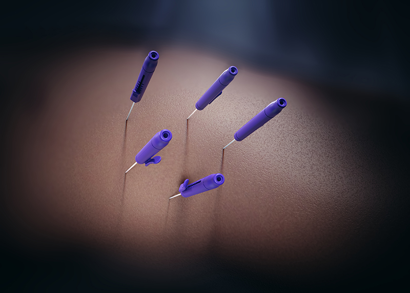 NanoKnifes_Probe_Closeup